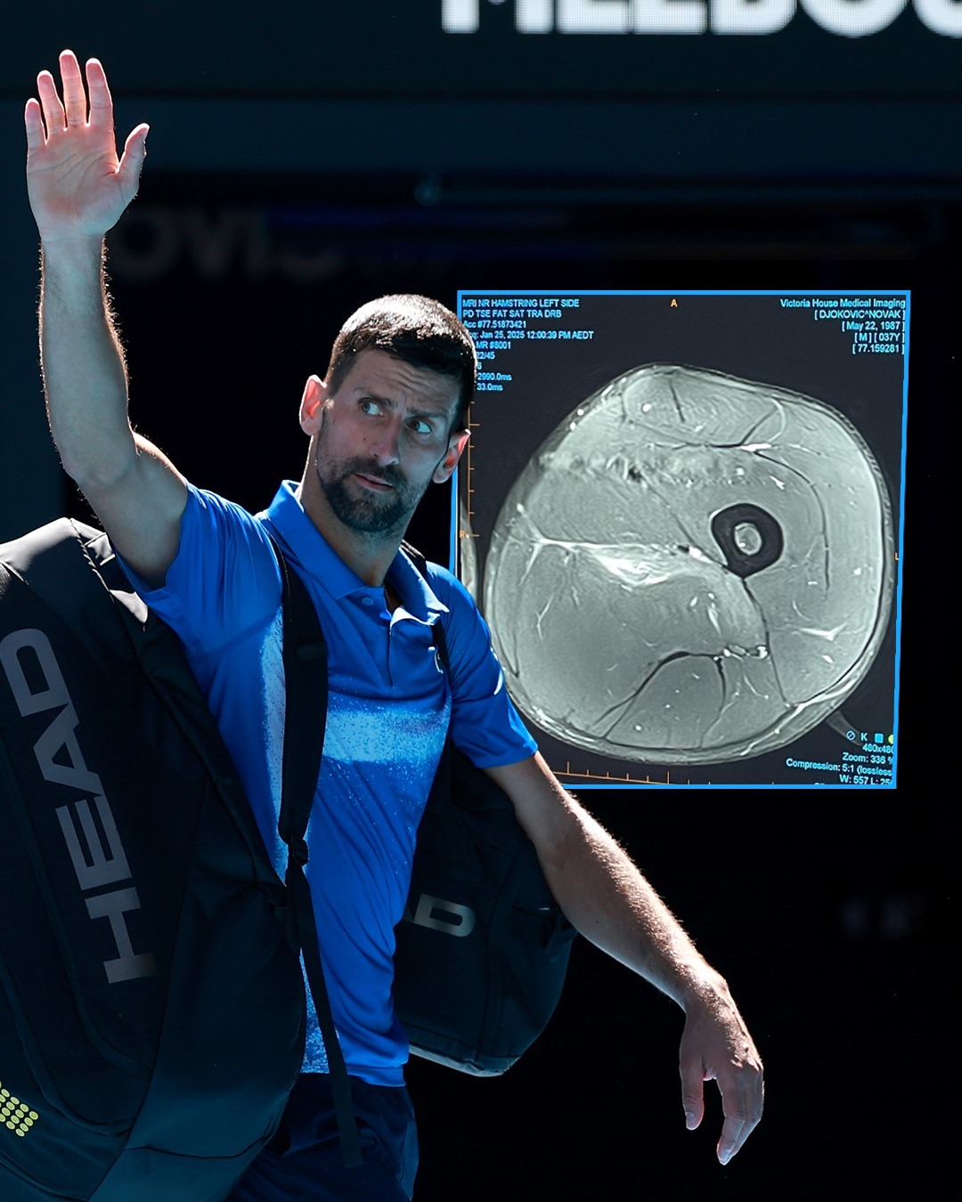 关于日本网球队险胜德国网球队,德约科维奇高光表现的信息 关于日本网球队险胜德国网球队,德约科维奇高光表现的信息